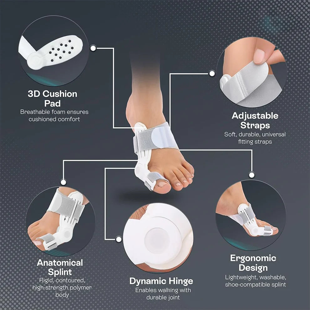 Pretty Buyers Hallux Valgus Corrector – Effective Toe Realignment Support