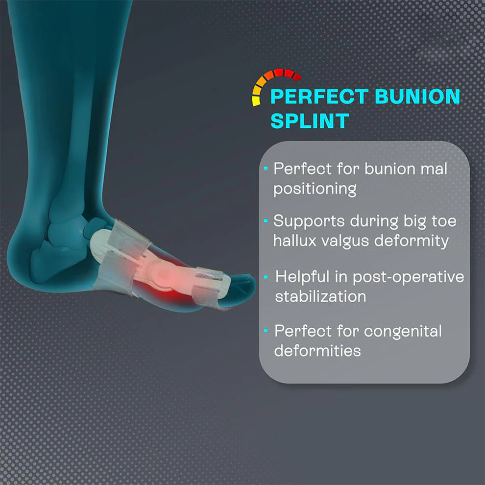 Pretty Buyers Hallux Valgus Corrector – Effective Toe Realignment Support