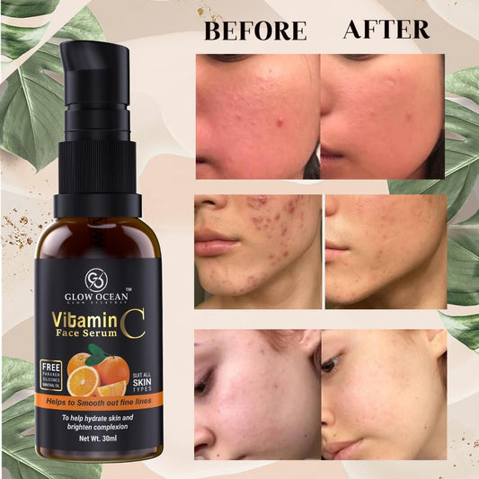 GlowOcean Vitamin C Serum - Skin Clearing Serum - Brightening, Anti-Aging Skin Repair, Supercharged Face Serum, Dark Circle, Fine Line & Sun Damage Corrector Face Serum 30ml