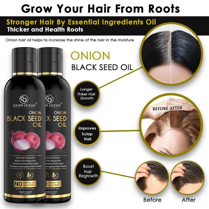 Ocean Onion Blackseed oil For Hair Fall Control,Hair Growth & Hair Regrowth-Control Dandruff (200Ml)