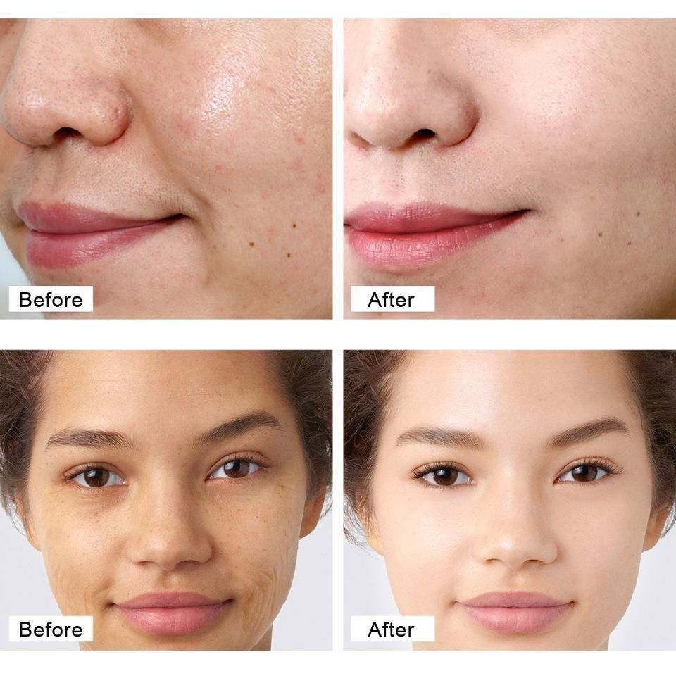 Retinol Anti Aging Face Cream & Face Serum (Pack Of 1)